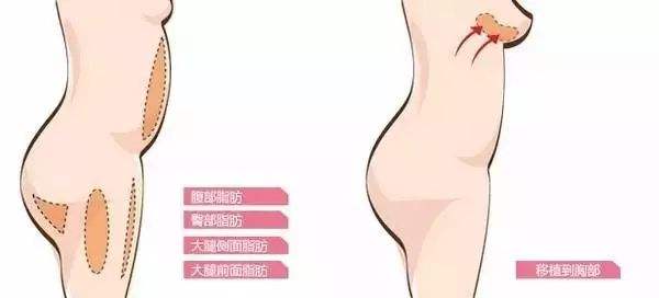 /uploads/picture/20190826/a25cd63cdef7129e441aefa5f4c49c86.jpg