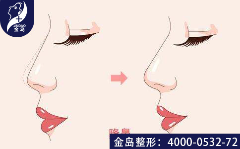/uploads/picture/20190815/31504c8f54ee11e7e3930398410d9862.jpg