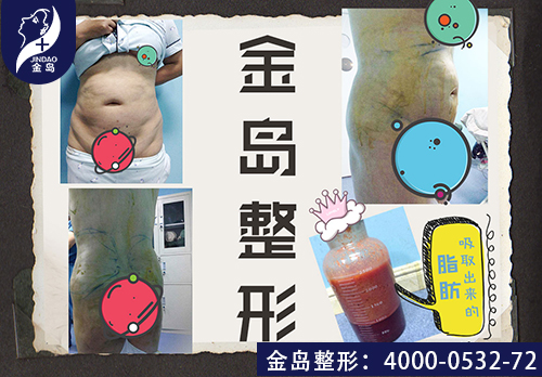 /uploads/picture/20190711/793aaea37a722f9d8d5ad26316761971.jpg